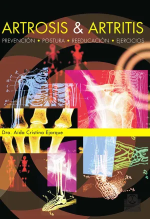 ARTROSIS & ARTRITIS. PREVENCIÓN, POSTURA, REEDUCACIÓN, EJERCICIOS ARTROSIS & ARTRITIS. PREVENCIÓN, POSTURA, REEDUCACIÓN, EJERCICIOS