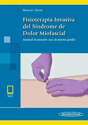 FISIOTERIA INVASIVA SÍNDROME DE DOLOR MIOFASCIAL +EBOOK